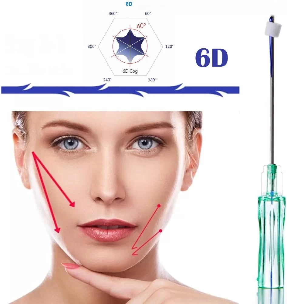 PDO Fäden COG 6D 21G 60mm L-Typ Stumpf (Augenbrauenlift,Jawline,Gesicht) – Image 3