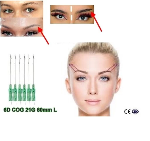 Sourcils ascenseur,pdo fils