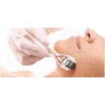 Meso HYALURON 8MG  Hauterneuerung  10 x 5ml