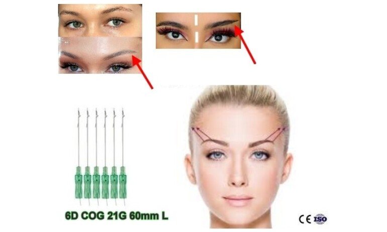 Eyebrow lift,pdo threads