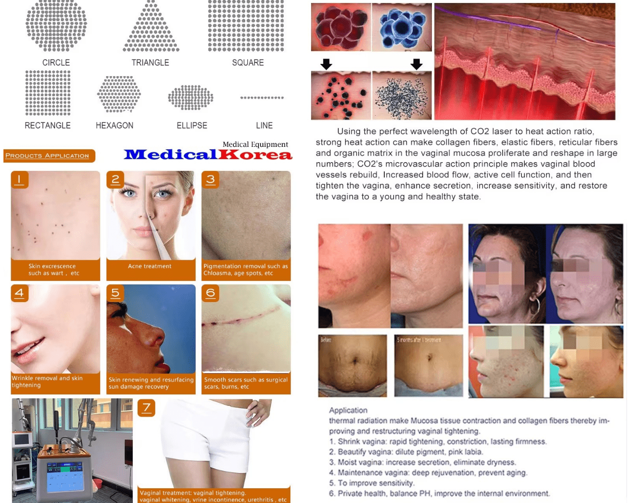 CO2 Fraktionierter Laser - immagine 8
