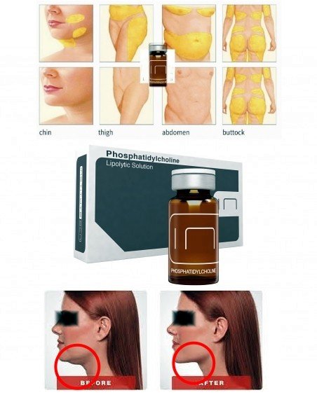 PPC Fettweg MESO 2 x 10ml - Anti-Cellutite/Doppelkinn